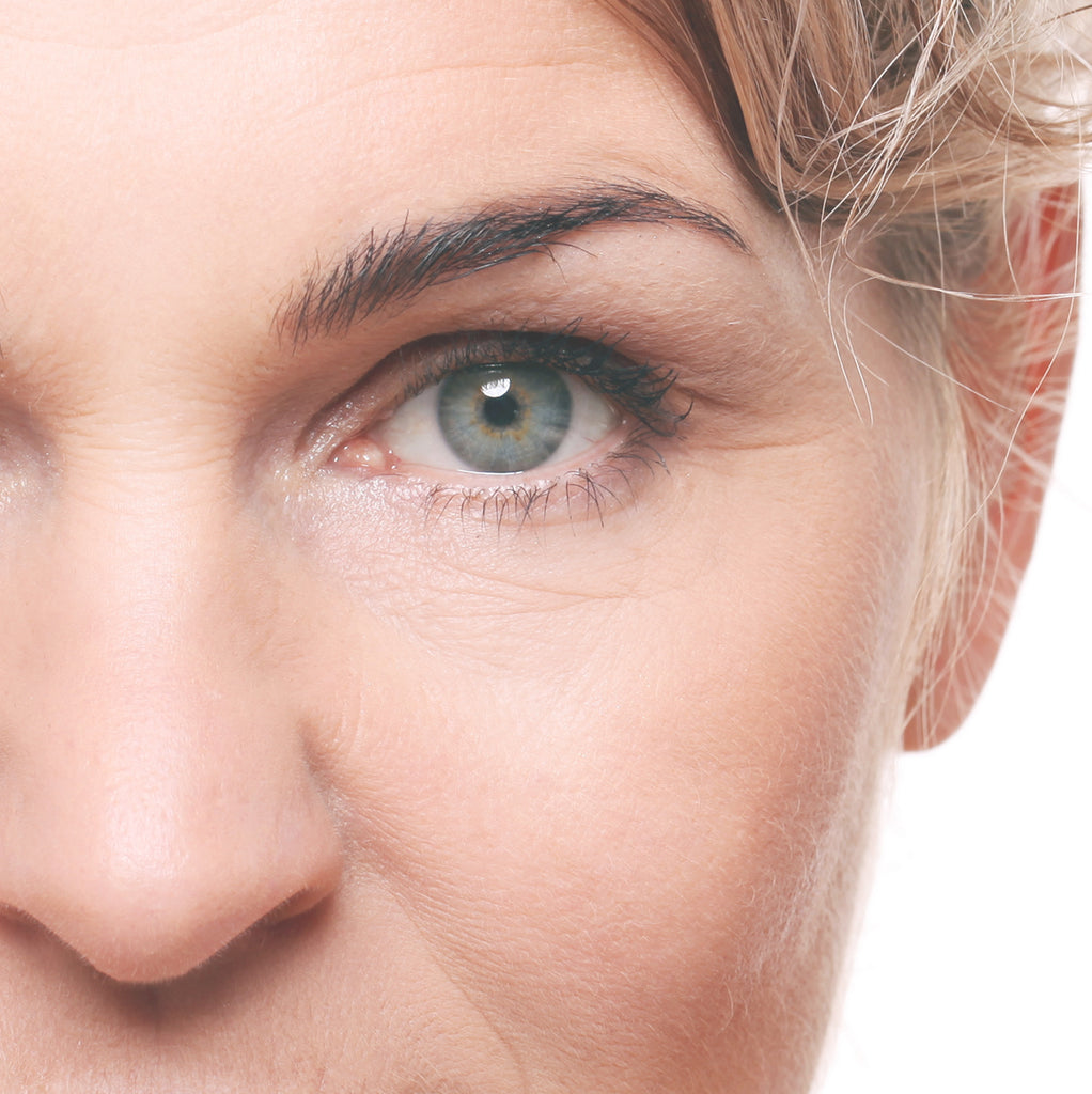 12 ways to reduce under eye wrinkles