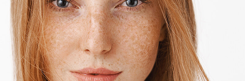 Sensitive Skin