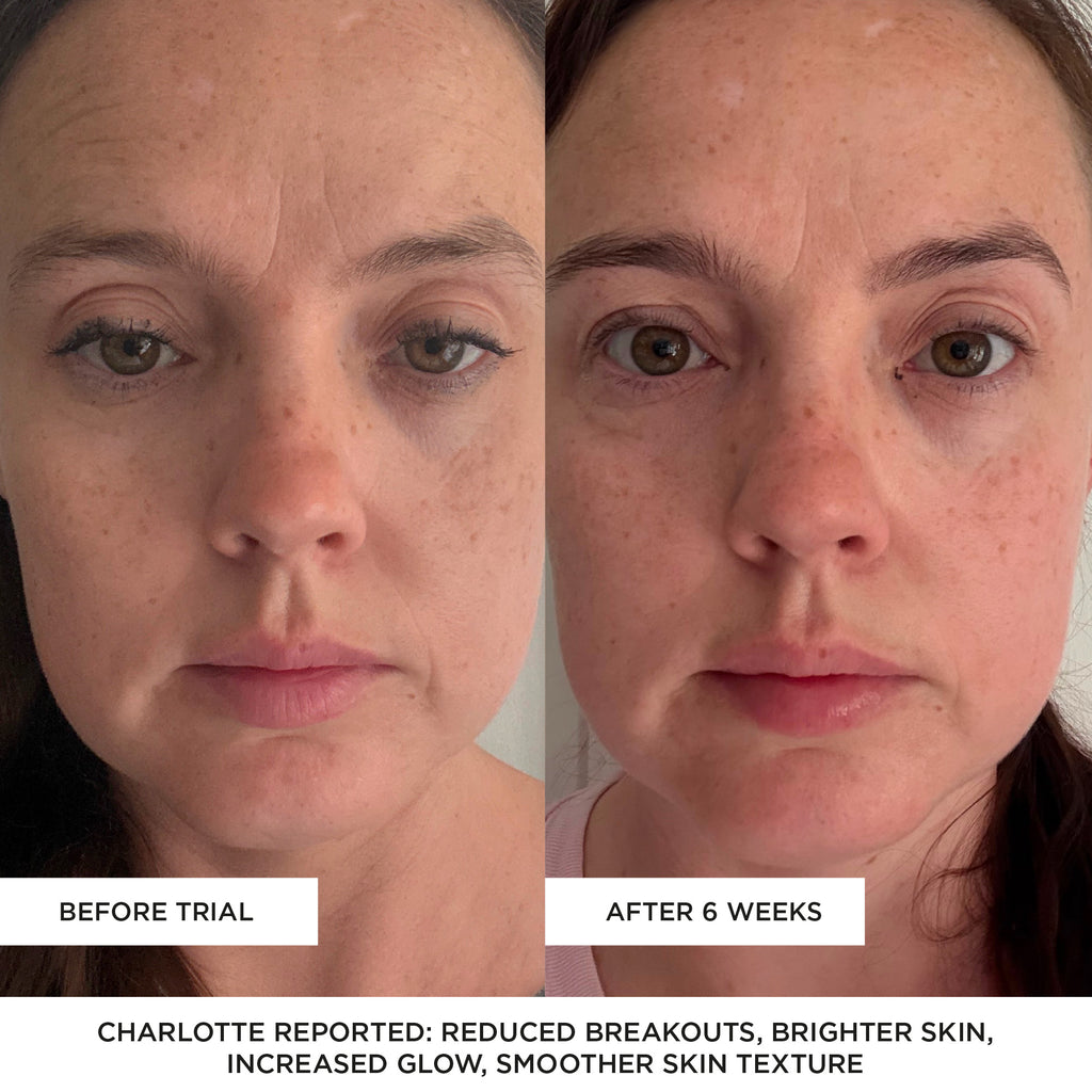 Before and after comparison of a woman's face with text indicating improvements after a 6-week trial.